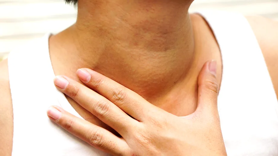 Ablația cu microunde, o nouă tehnică de tratare a nodulilor tiroidieni, se practică acum și în România