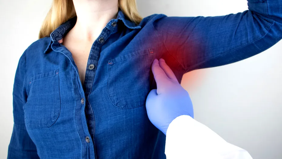 Cancerul de sân nu se manifestă întotdeauna printr-un nodul. Semnul de pe piele la care trebuie să fii atentă