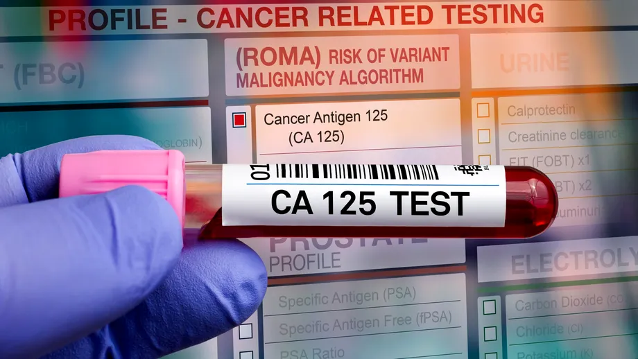 Testul sau scorul ROMA: ce este, când se recomandă, valori normale și limite