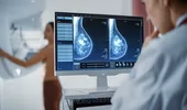 Mamografia este periculoasă din cauza radiațiilor? 8 mituri false despre screeningul cancerului mamar