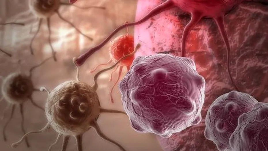 Cercetătorii şi-au dat seama cum se răspândeşte cancerul în organism