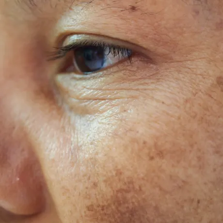 Această greșeală de skincare le îmbătrânește pe femeile sub 30 de ani, avertizează dermatologii