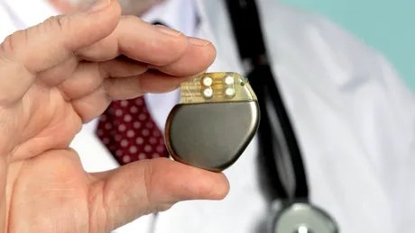 Ce este un stimulator cardiac și care sunt semnele că ai nevoie de un astfel de dispozitiv. 10 întrebări și răspunsuri despre pacemaker