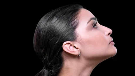 Linii mai închise pe gât? Medicii explică cum acestea pot fi legate de sănătatea inimii, diabetul sau ficatul gras