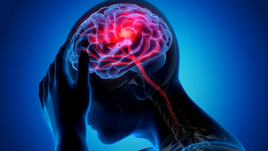 Un bărbat a suferit migrene severe timp de 12 ani. Durerile au dispărut după ce a început să mănânce aceste alimente