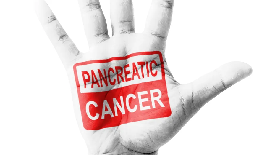 Un virus gripal modificat ar putea distruge tumorile pancreatice