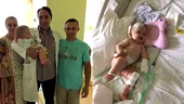 Bebeluş cu o malformaţie congenitală cerebrală rară operat cu succes în România