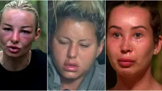 De ce li s-a umflat, de fapt, fața vedetelor de la „Survivor”? Adevărul din spatele transformărilor care au stârnit controverse