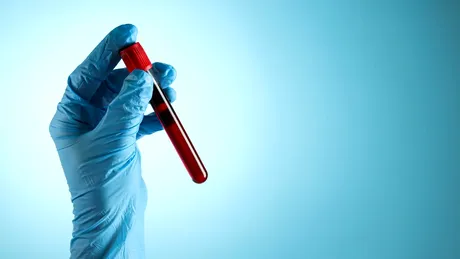 O grupă sangvină, potențial factor de risc pentru cancerul de sân