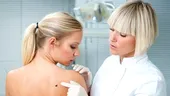Factorii de risc pentru melanom, cel mai agresiv cancer de piele!