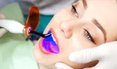 Tratament cu laser pentru parodontoză: avantaje şi recomandări