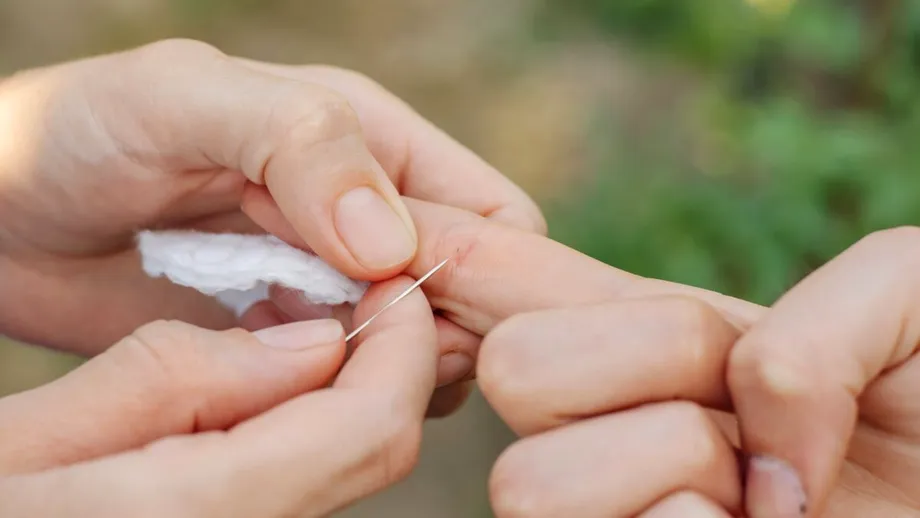 Cum scoți o așchie din deget rapid. Trucul viral pe care trebuie să-l încerci / VIDEO