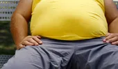 Operaţiile pentru pacienţii cu obezitate morbidă, decontate de stat?