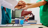 Boala care poate distruge ficatul timp de 30 de ani fără niciun simptom