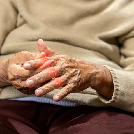 Legume care pot reduce nivelul acidului uric într-o singură lună. Sunt excelente dacă suferi de gută, dar nu substituie tratamentul medicamentos!