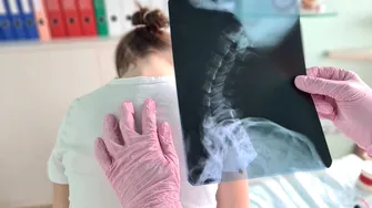 Cum afectează telefonul postura copiilor. Osteopat: „Lipsa mișcării este cauza reală, nu telefonul în sine”