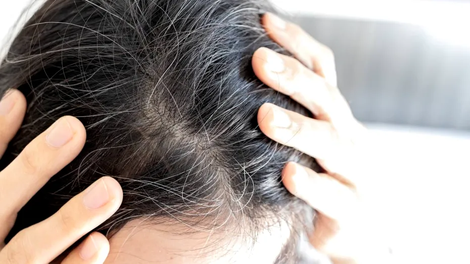 Albirea părului este reversibilă! Ce trebuie să faci și la ce să fii atent, de fapt