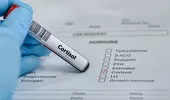 14 semne care apar când cortizolul scapă de sub control