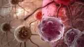 Cercetătorii şi-au dat seama cum se răspândeşte cancerul în organism