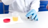 Ce îți poate spune culoarea urinei despre sănătate. Semnele care pot indica probleme ale rinichilor sau ficatului