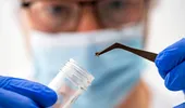Formă rară de boală Lyme depistată recent: simptome mai severe și avertismentul medicilor