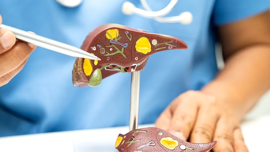 Remediul natural care regenerează ficatul gras. O cană pe zi este suficientă pentru sănătatea ficatului