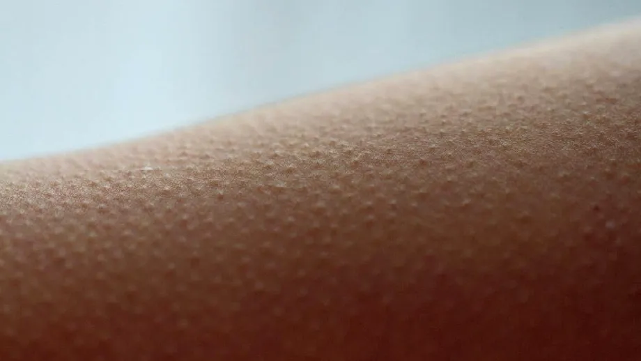 De ce ni se face pielea de găină când ascultăm muzică? Ce se întâmplă în creier și în organism