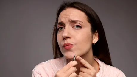 Părul în exces nu este doar o problemă estetică: semnalul de alarmă al corpului tău