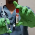 Vaccinul împotriva zonei zoster ar putea reduce riscul de infarct și AVC. Ce arată un nou studiu