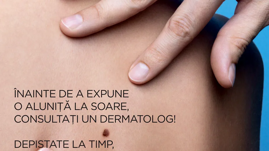 (P) Stiati ca 90% din cancerele de piele sunt vindecabile daca sunt depistate la timp?