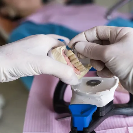 Stomatologul care și-a mutilat pacienții: le scotea dinții sănătoși ca să le pună proteze scumpe. Câștiga 80.000 de euro pe lună