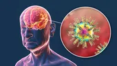 Virusurile comune care pot duce la declanșarea bolii Alzheimer. Descoperirile îngrijorătoare ale unui studiu
