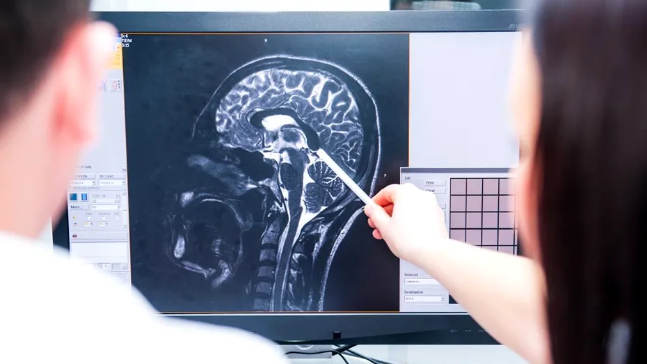 Cum să-ți menții creierul sănătos. Obiceiuri recomandate de neurolog, care previn declinul cognitiv