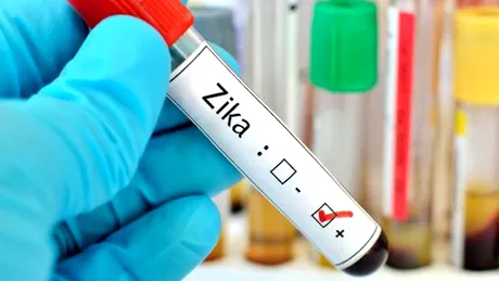 Virusul ZIka - infectare, simptome, testare şi complicaţii