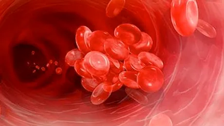 Trombofilie: simptome, tratament