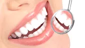 Albirea dentară în cabinetul stomatologic