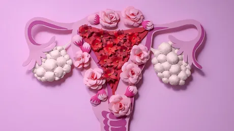 De ce sindromul ovarelor polichistice reprezintă una dintre cele mai frecvente cauze de infertilitate la femeile tinere?