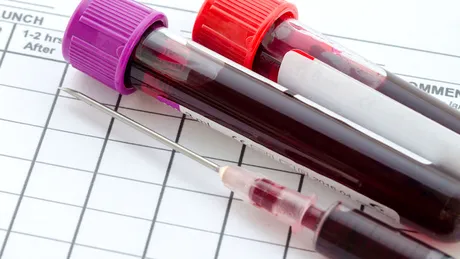 Dr. Antoanela Curici: analize şi teste în diabet VIDEO by CSID