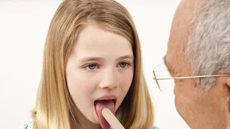 Când este necesară operaţia de extirpare a amigdalelor la copii