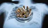 Cum să-ți cureți plămânii după ce te-ai lăsat de fumat. Primul lucru care se întâmplă în corp după ultima țigară