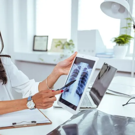 Descoperirea ireală făcută de un medic în corpul unei femei. A trăit 30 de ani cu obiectul străin: „Migrase și stătea cuminte în plămân”