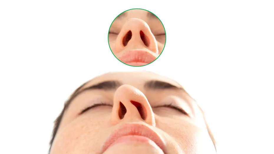 Rinoseptoplastia, operația 2 în 1: corectează aspectul nasului și deviația de sept