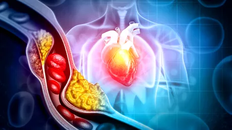Alimentele care „sugrumă” inima cu colesterol. Ce să mănânci ca să cureți sângele de grăsime