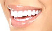 10 paşi premergatori unui implant dentar