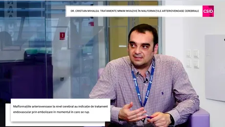 Dr. Cristian Mihalea: cum se tratează minim invaziv malformațiile arteriovenoase cerebrale