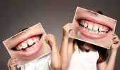 Boala dentară care se poate transmite de la părinte la copil prin simplul pupat