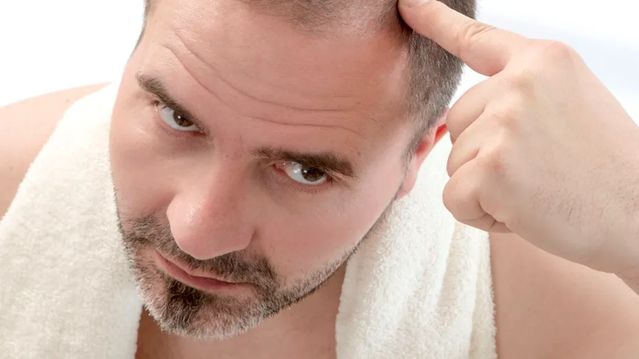 Alopecia: cauze, tratament, prevenţie