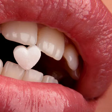 Ai grijă de dinți, ca să nu ai probleme cu inima! Ce impact negativ are boala parodontală asupra inimii și creierului