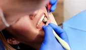 Vrei să-ți păstrezi dinții sănătoși până la bătrânețe? Cele 10 reguli recomandate de stomatologi