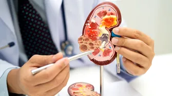 Acid uric vs creatinină: ce spun, de fapt, analizele despre sănătatea rinichilor